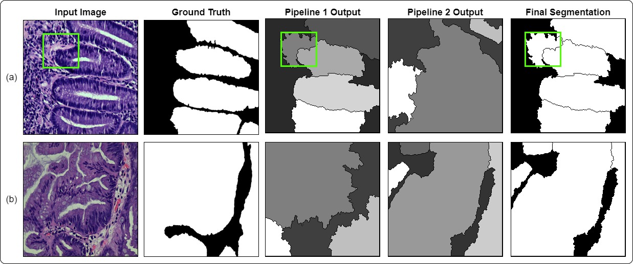 Image for Multi-class Classification and Gland Segmentation of Colorectal Cancer Tissues from Histopathology Images