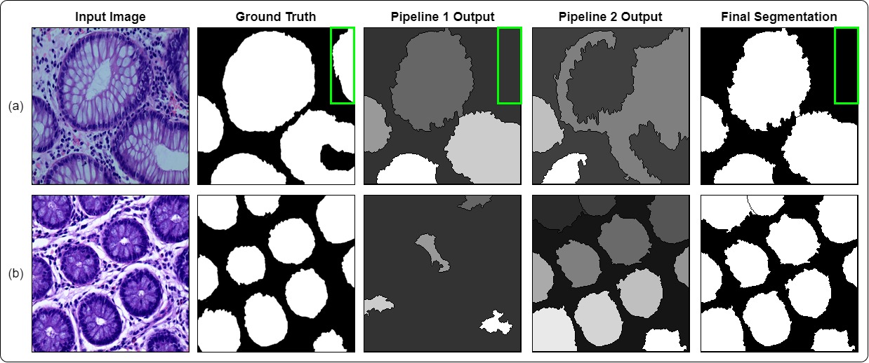 Image for Multi-class Classification and Gland Segmentation of Colorectal Cancer Tissues from Histopathology Images