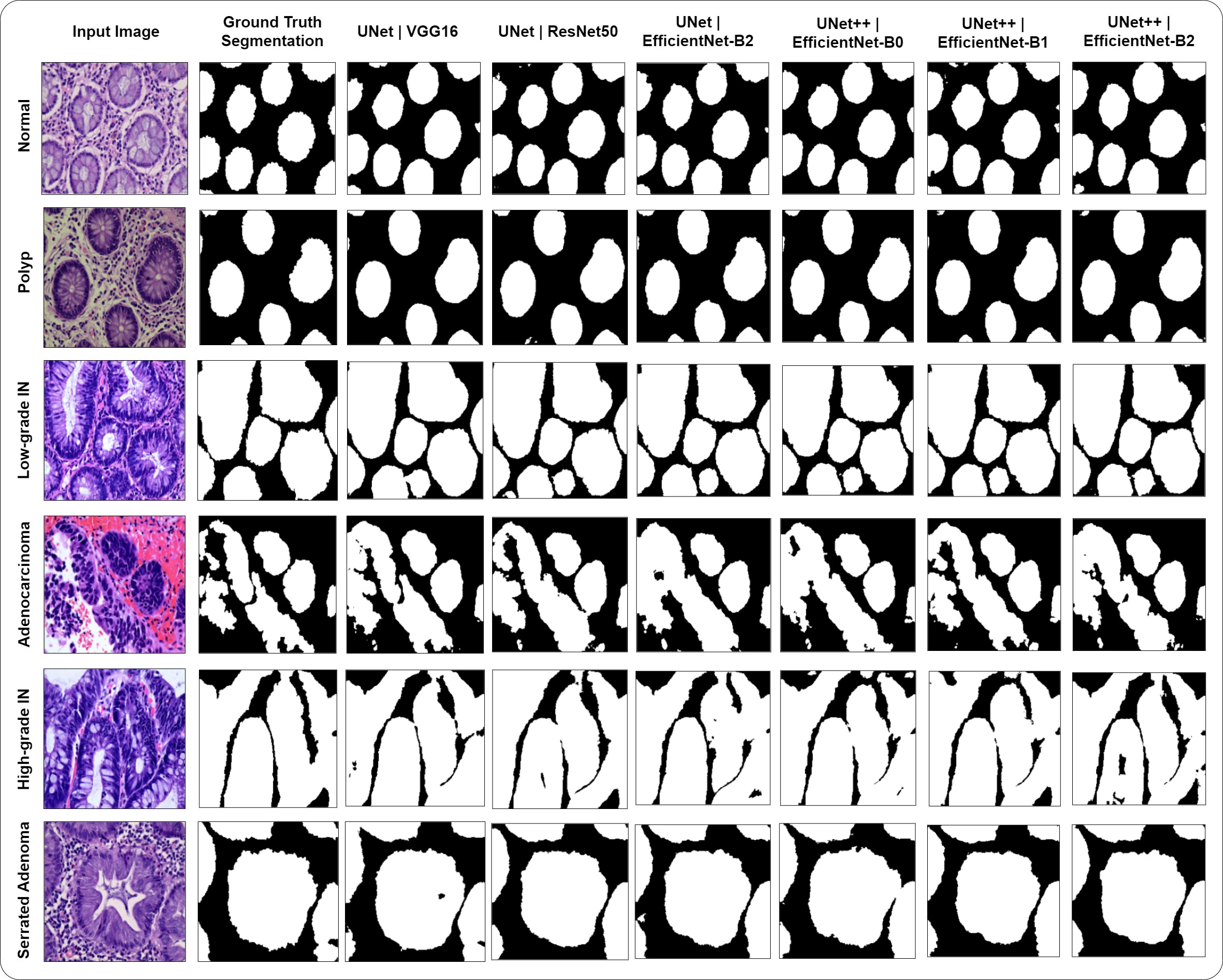Image for Multi-class Classification and Gland Segmentation of Colorectal Cancer Tissues from Histopathology Images