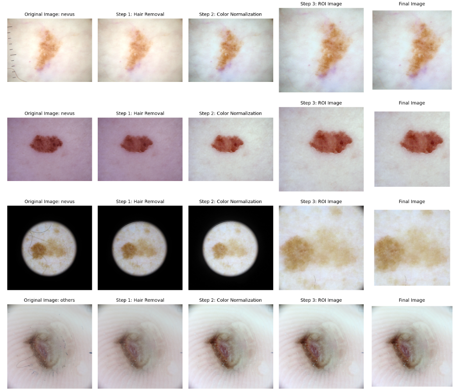 Image for Skin Cancer Classification: Machine Learning vs Deep Learning Techniques