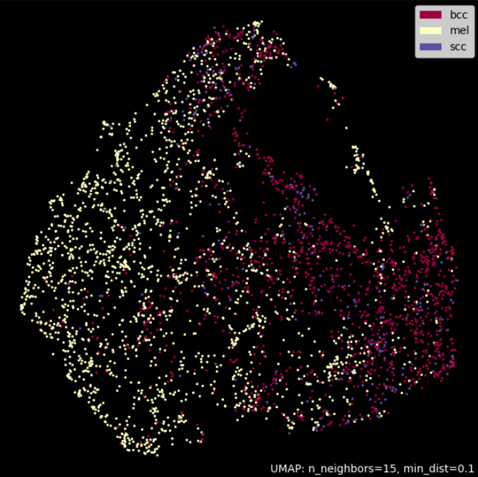 Image for Skin Cancer Classification: Machine Learning vs Deep Learning Techniques